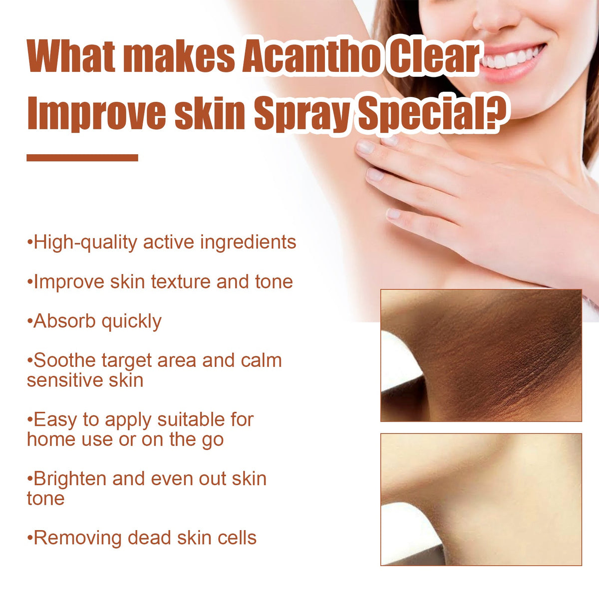 Acantho Clear Spray for Dark Elbows & Knees