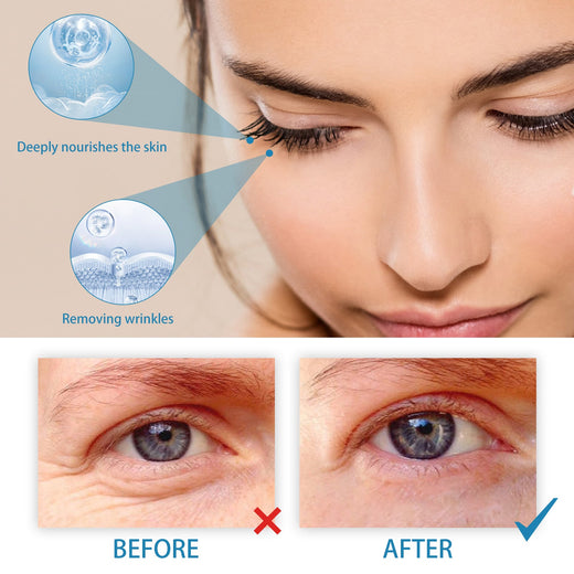 Retinol Eye Cream for Wrinkles, Dark Circles & Puffiness
