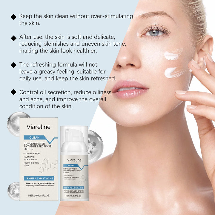 Soothing Anti-Acne Repair Lotion for Oily, Dry Skin