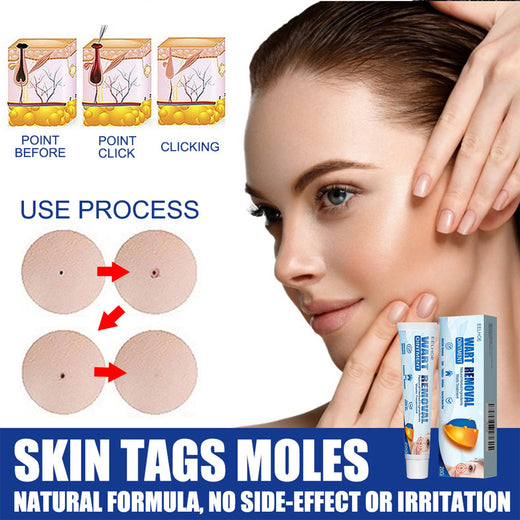 Keyu Cream Clean Skin Repair Care Body Face Remove Face Labe