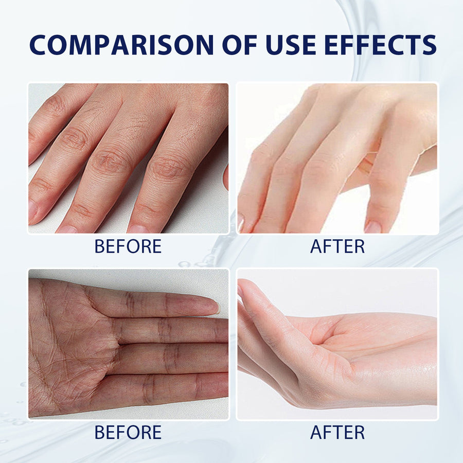 Aloe Vera Hand Cream for Dry, Cracked Skin Repair
