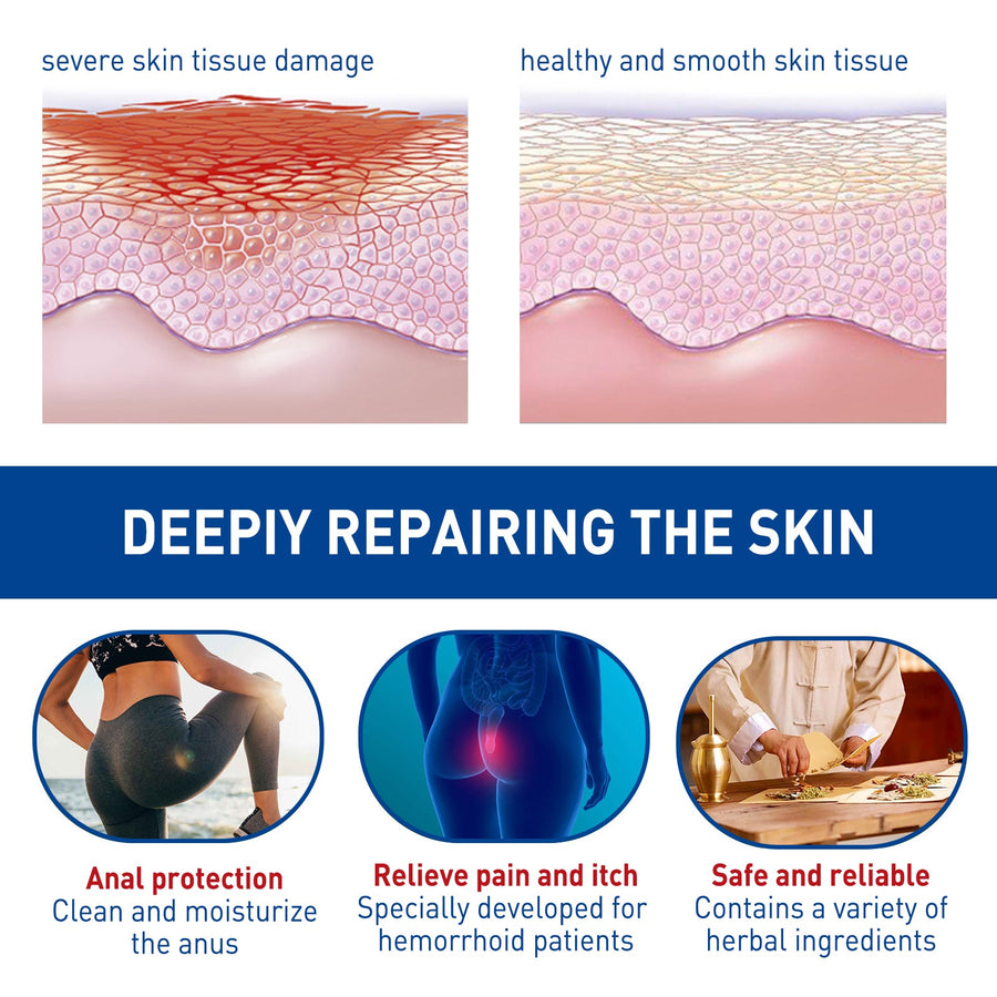 Hemorrhoid Cream — Fast Relief for Internal & External