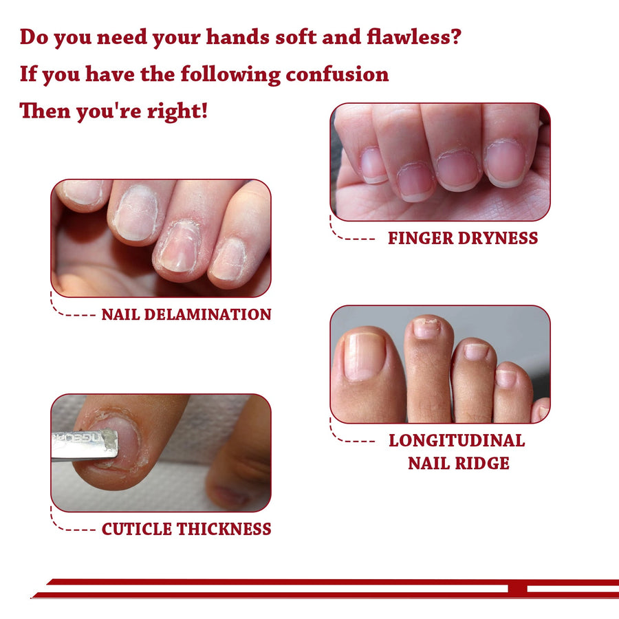 Cuticle Nail Treatment Oil — 100% Natural Jojoba for Soft Hands