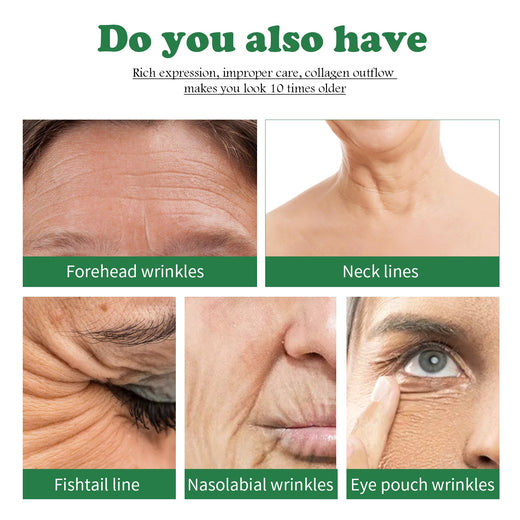 Anti-Aging Serum — 30-Day Intensive Wrinkle & Spot Treatment