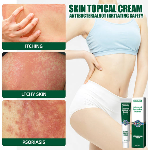 Herbal Soothing Cream for Dry, Itchy & Irritated Skin