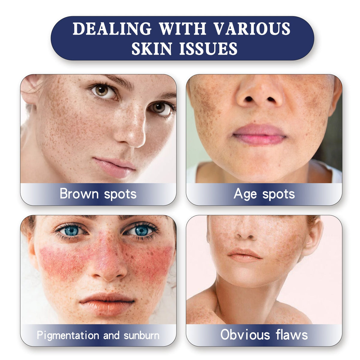 Skin Genesis Spot Cream: Even Tone, Fade Dark Spots