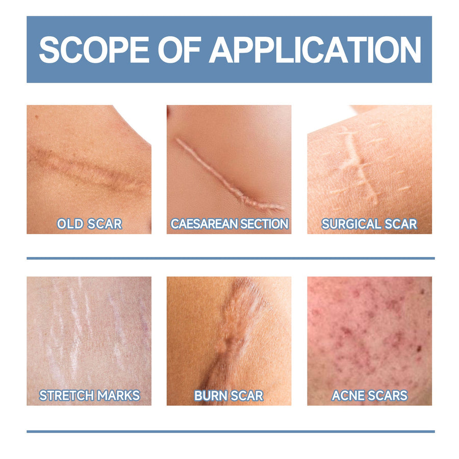 Oceaura Scar Gel: Fade C-Section & Surgery Scars in 8 Weeks