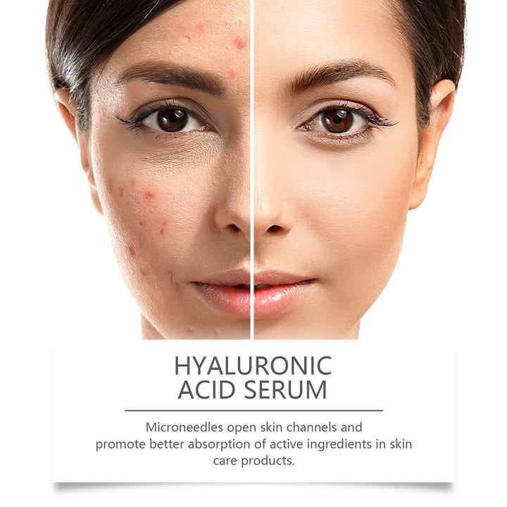 Hyaluronic Acid Face Serum for Hydrated, Smooth Skin