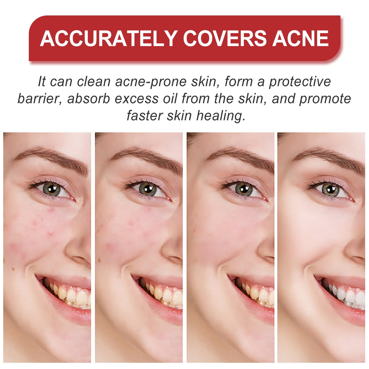 Hydrocolloid Acne Patches - Cute Shapes, 180 Count Pack