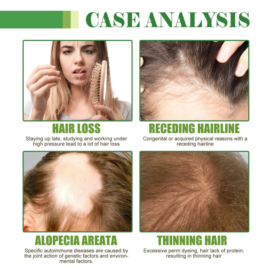Hair Care Oil for Dry Hair, Shine & Frizz Control