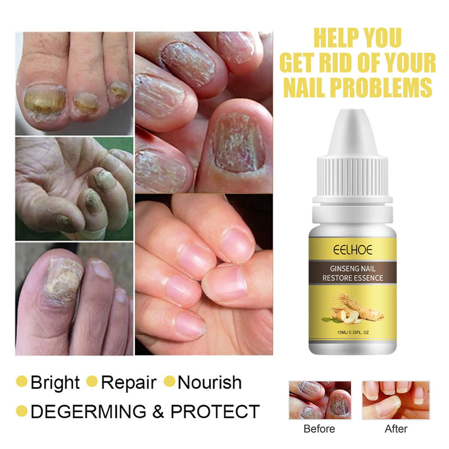 Ginseng Nail Repair Essence — Brighten & Strengthen Damaged Nails