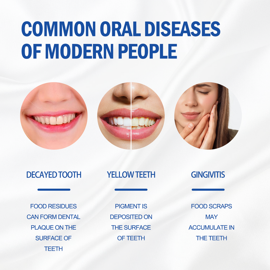 SP-4 Whitening Toothpaste – Fresh Breath & Tartar Removal