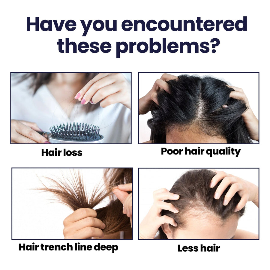 Hair Treatment Spray for Thinning, Dry Damaged Hair