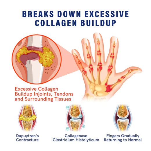 Joint Care Cream — Restore Joint Flexibility & Relieve