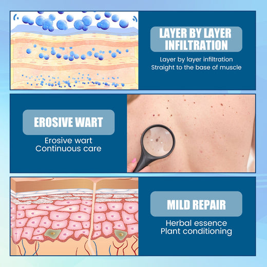 Skin Tag Patches with Natural Herbal Extract, 144 Ct