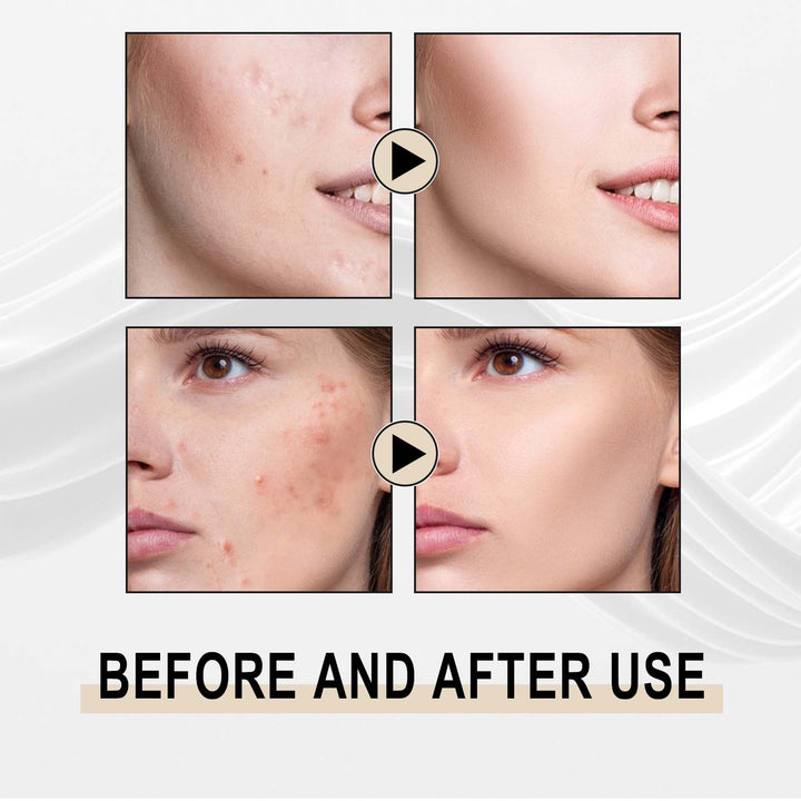 Lactobionic Acid Serum for Smoother-Looking Pores