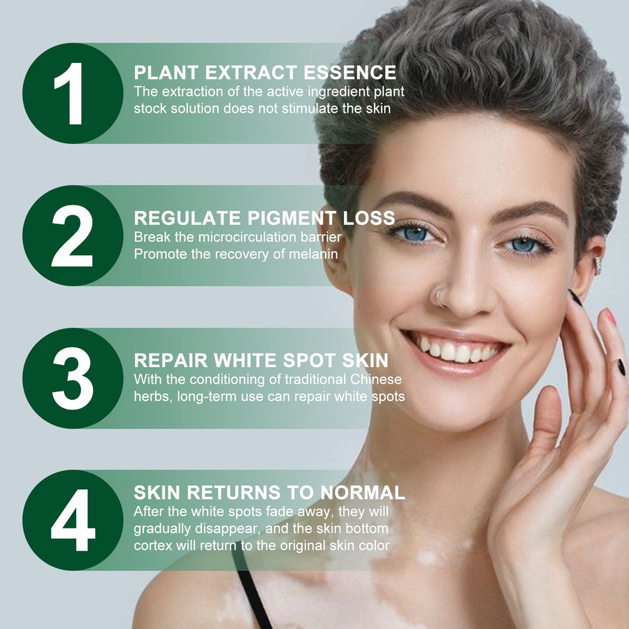 Vitiligo Care Cream for a More Even-Looking Skin Tone