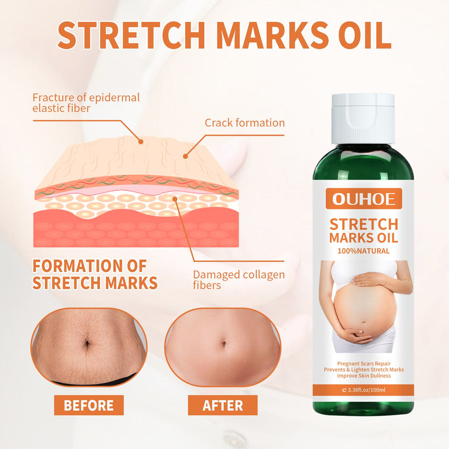 Pregnancy Massage Oil – Prevent & Lighten Stretch Marks Naturally
