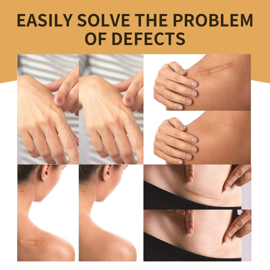 Skin Concealer Patch for Invisible Scar & Tattoo Cover