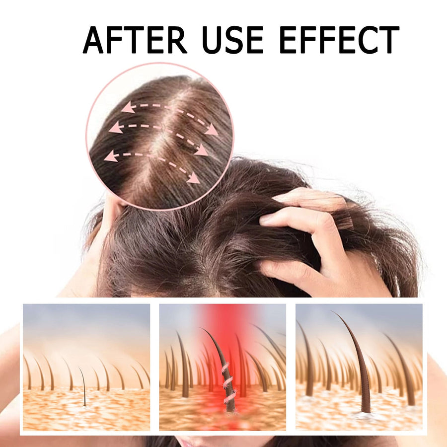 Hair Growth Serum With Scalp Roller for Fuller-Looking Hair