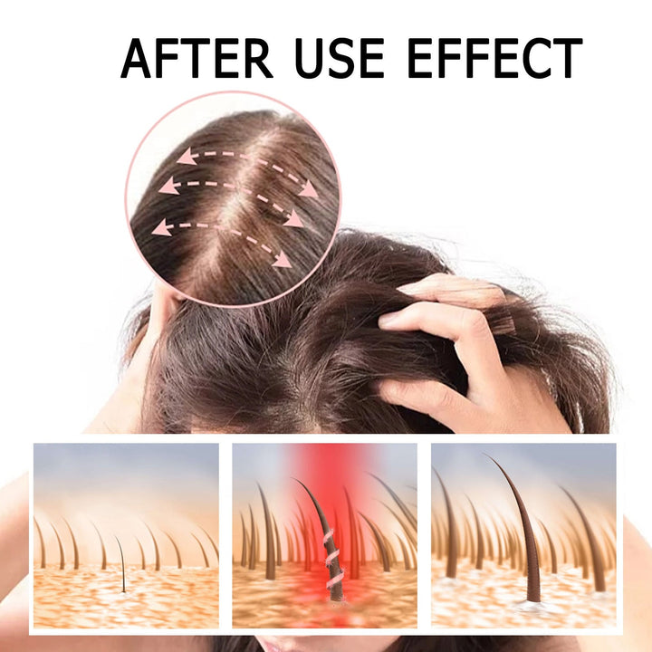 Hair Growth Serum With Scalp Roller for Fuller-Looking Hair