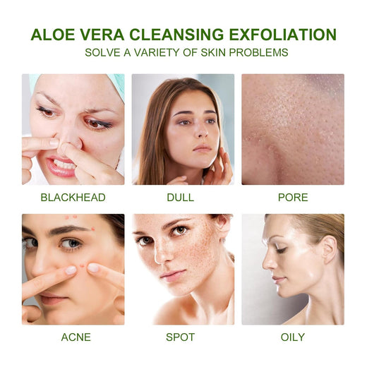 Aloe Vera Exfoliating Scrub for Acne Marks & Dull Skin