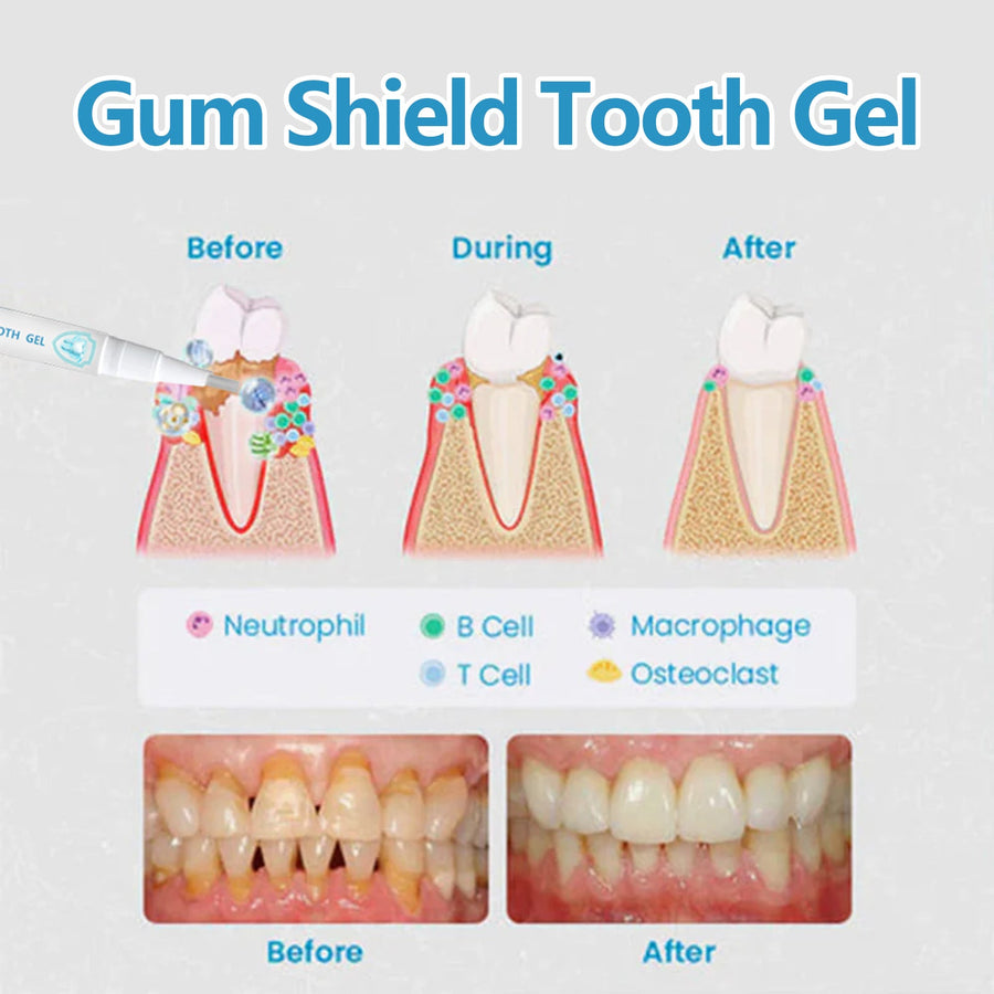 Teeth Whitening Pen — Gum Shield Solution for 99.99% Oral