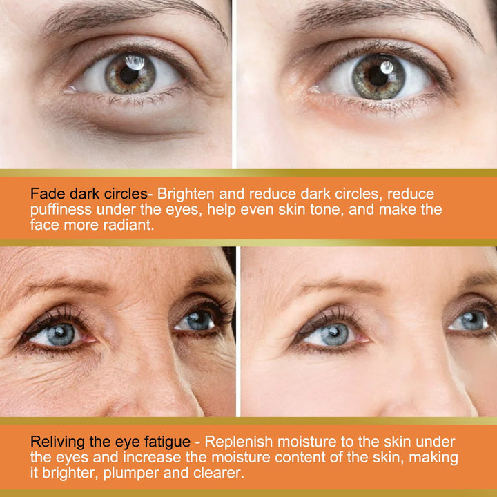 Vitamin C Eye Balm Stick for Dark Circles & Puffiness