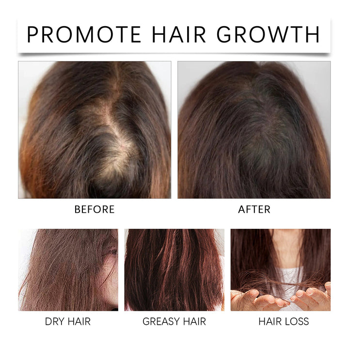 Rosemary Hair Growth Oil for Dry, Fragile Hair Care