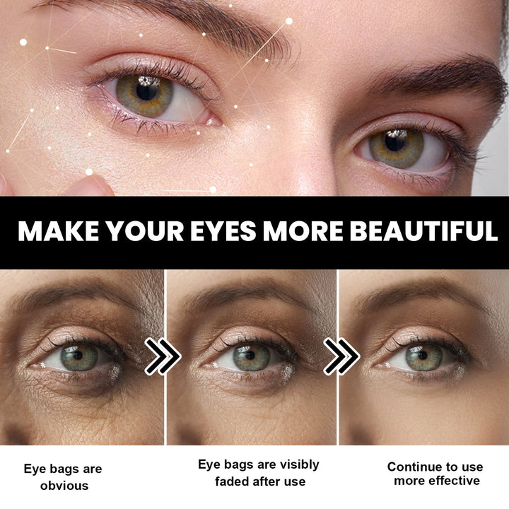 Conopeptide Eye Cream for Bags, Dark Circles & Firming