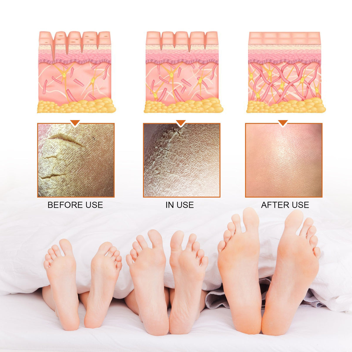 Exfoliating Foot Spray for Cracked Heels & Dead Skin