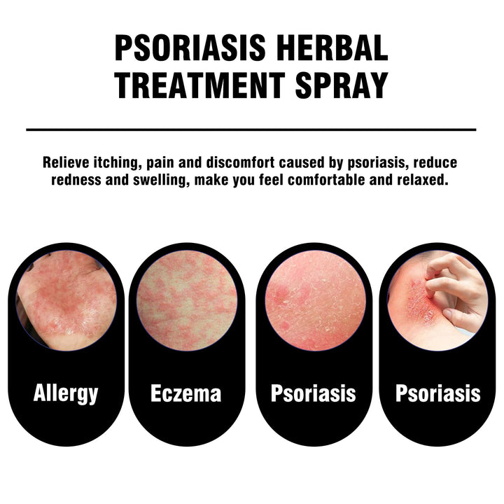 Herbal Spray For Hands And Feet