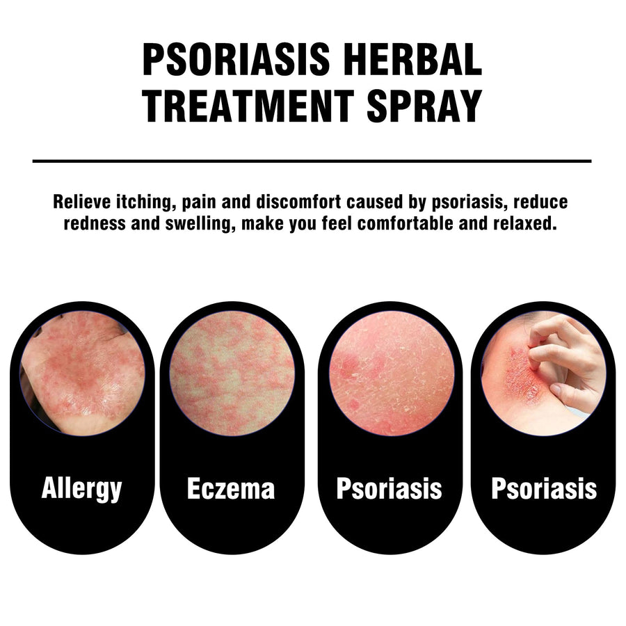 Herbal Psoriasis Spray for Hands & Feet Relief