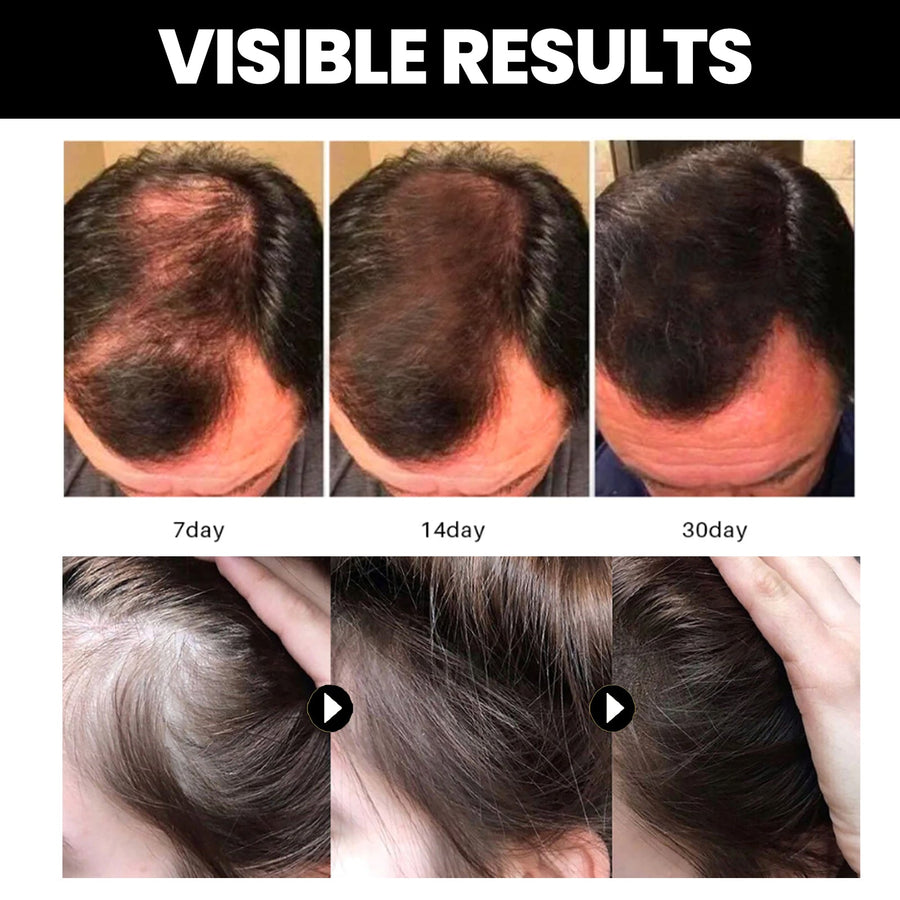 Batana Hair Oil for Smoothing & Nourishing Aging Hair