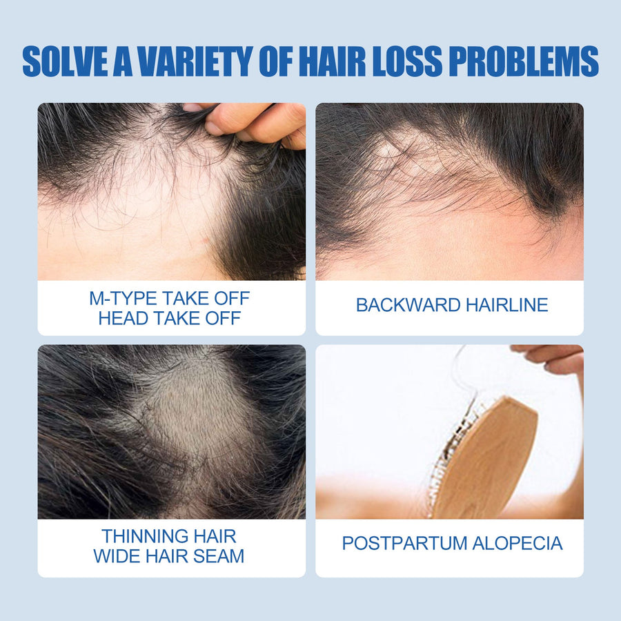 5% Minoxidil Hair Regrowth Treatment for Men, 60ml