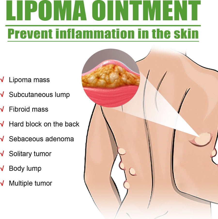 Lipoma Cream — Lipolysis Fat Lump Removal & Nodular Relief