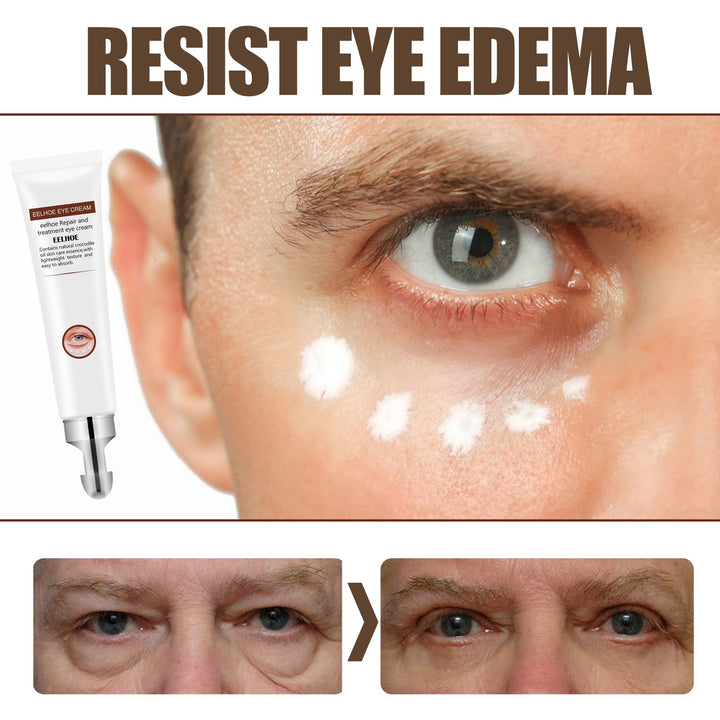 Jojoba Eye Cream Roller for Dark Circles and Puffy Bags