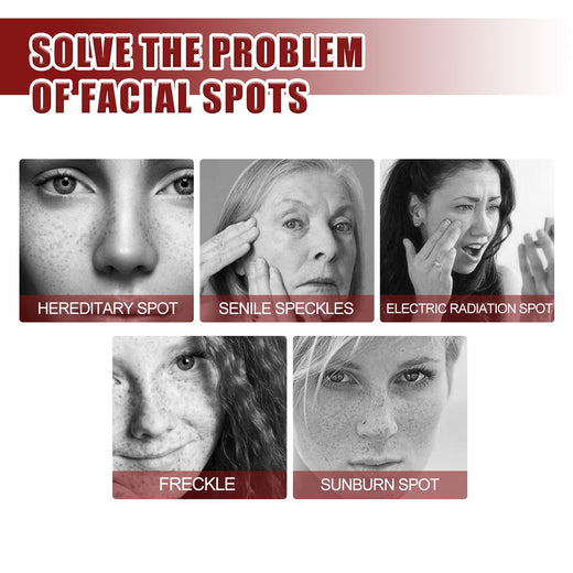 Brightening Cream for Dark Spots & Uneven Skin Tone