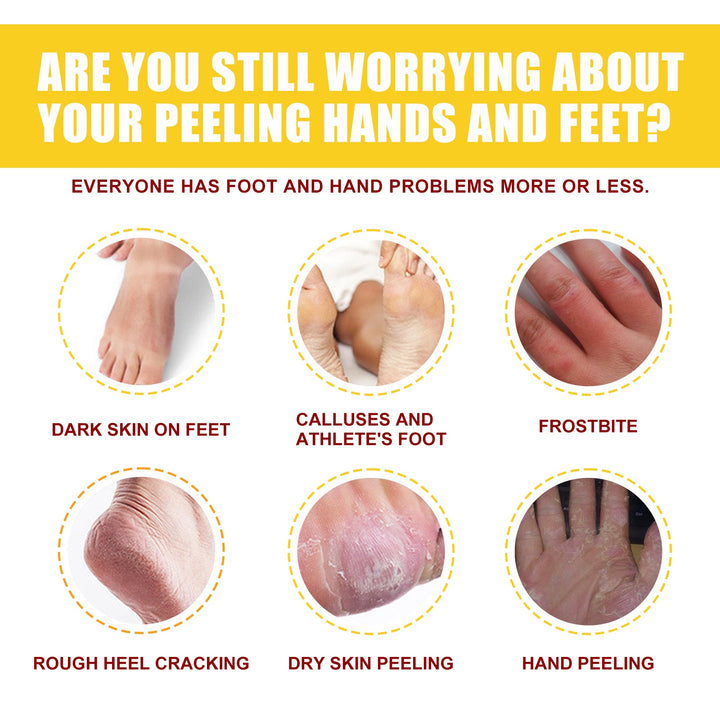 Horse Oil Repair Cream for Cracked Heels & Hands