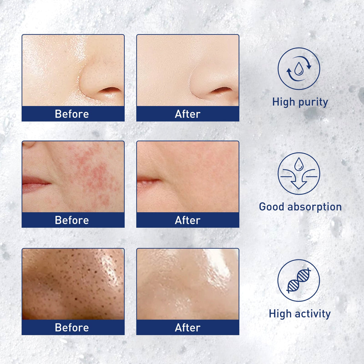 Exfoliating Mousse Cleanser for Pores & Blackheads