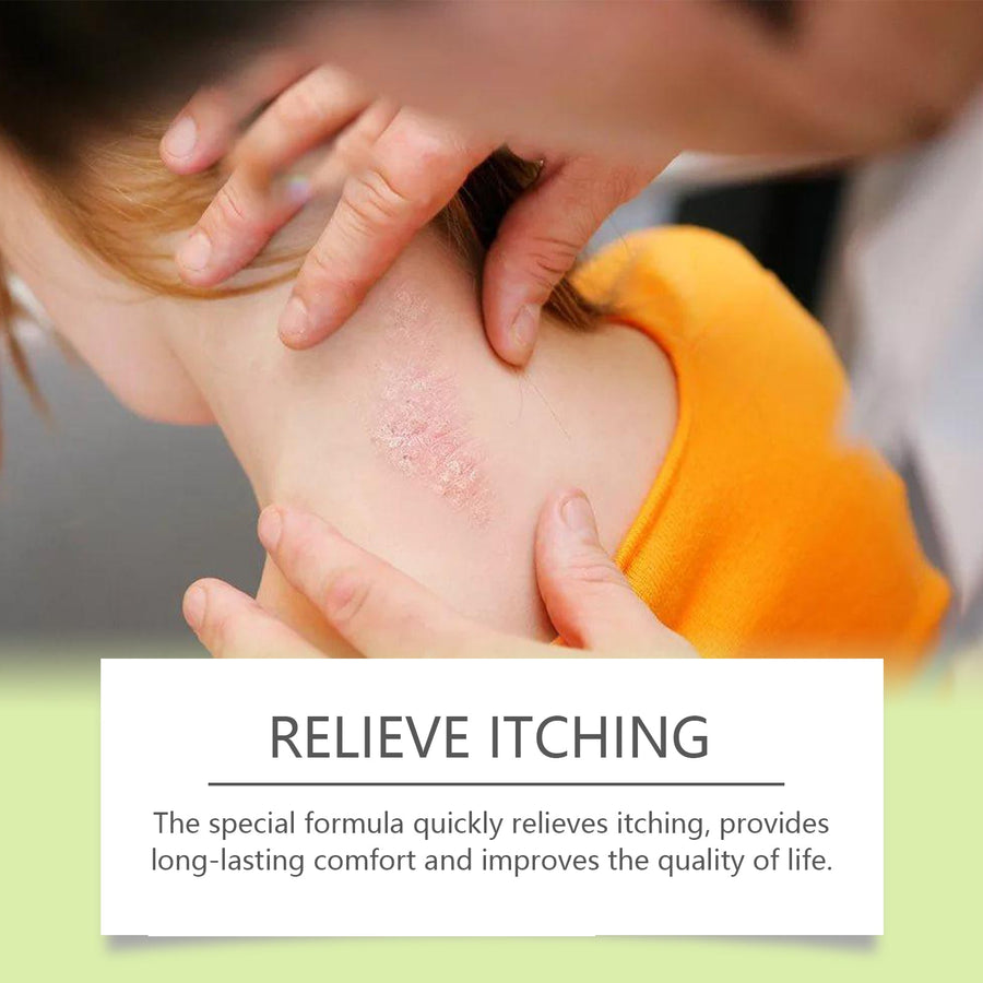 Herbal Antibacterial Cream for Itchy Dry Hands and Feet