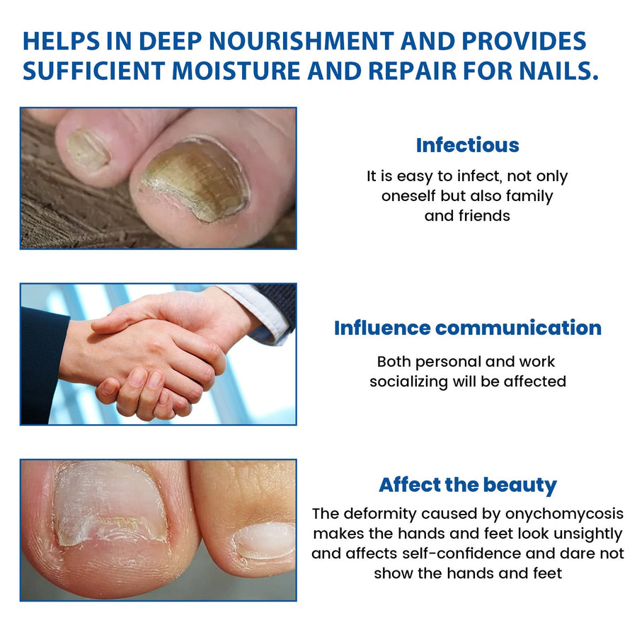 Fungal Nail Patch Treatment — Clearer, Healthier Nails