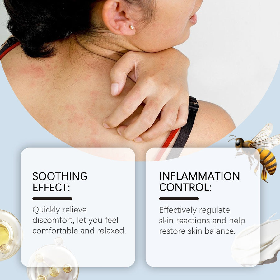 Herbal Eczema Relief Cream for Dry, Red, Irritated Skin