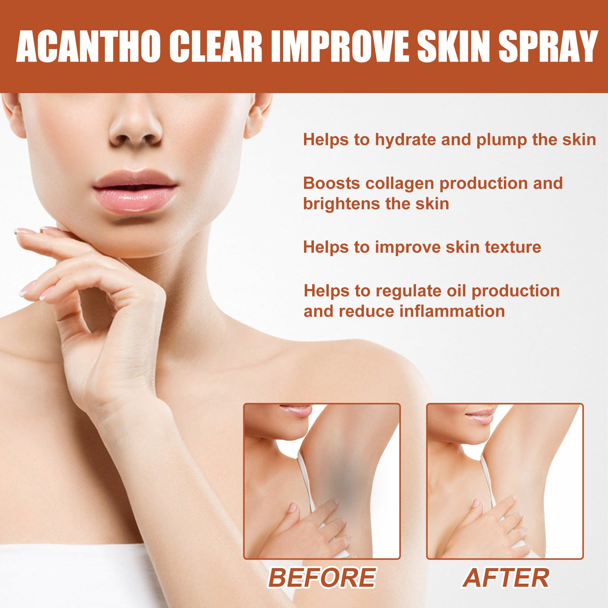 Acantho Clear Spray for Dark Elbows & Knees