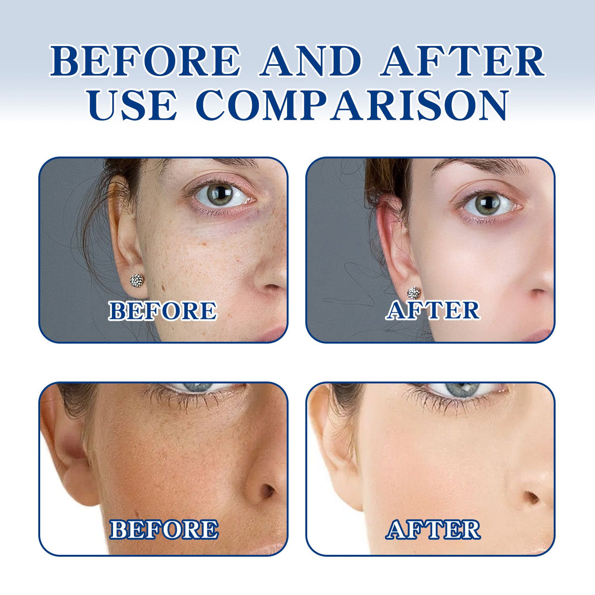 Ouhoe Brightening Cream Brightening Complexion Lightening Fa