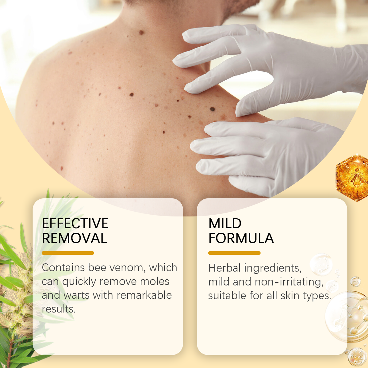 Bee Venom Blemish Spray for Warts & Skin Imperfections