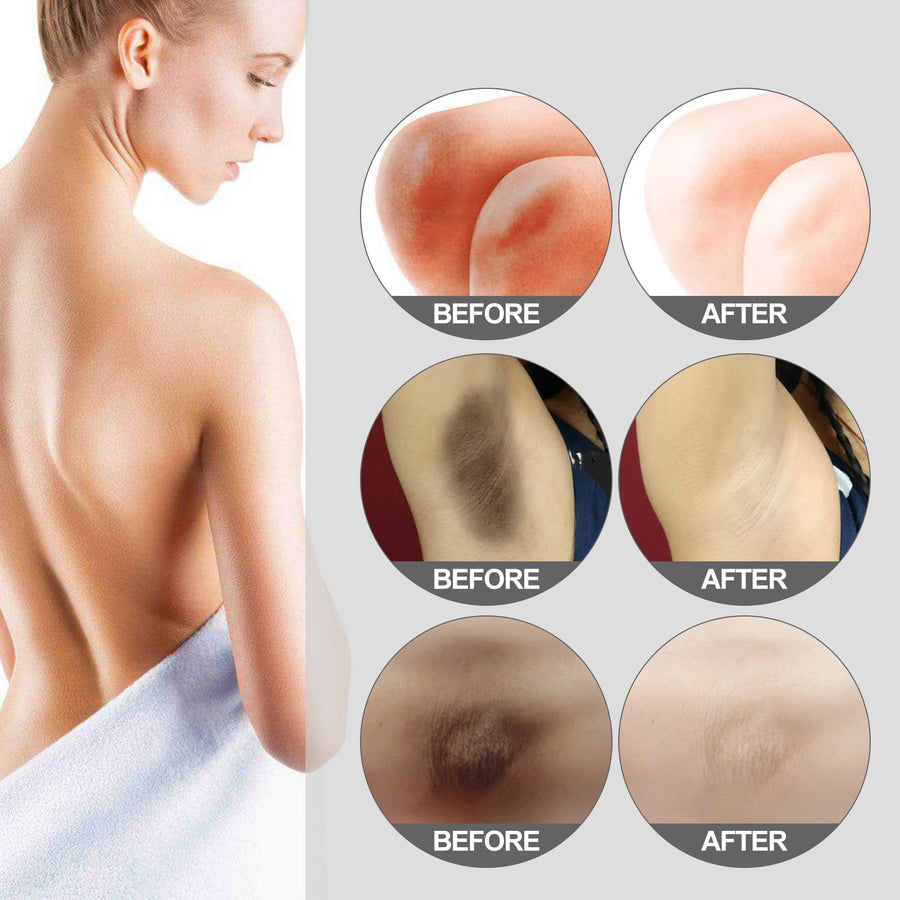 Skin Brightening Cream — Fades Dark Spots on Sensitive Areas