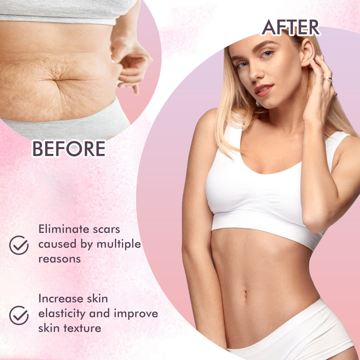 Body Oil for Stretch Marks, Scars & Fine Lines Repair