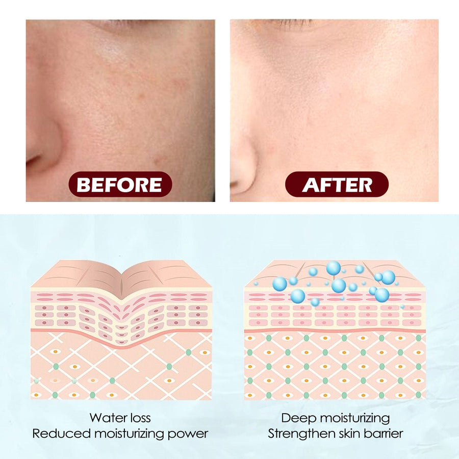 Glycolic Salicylic Pads for Clear, Smooth Skin