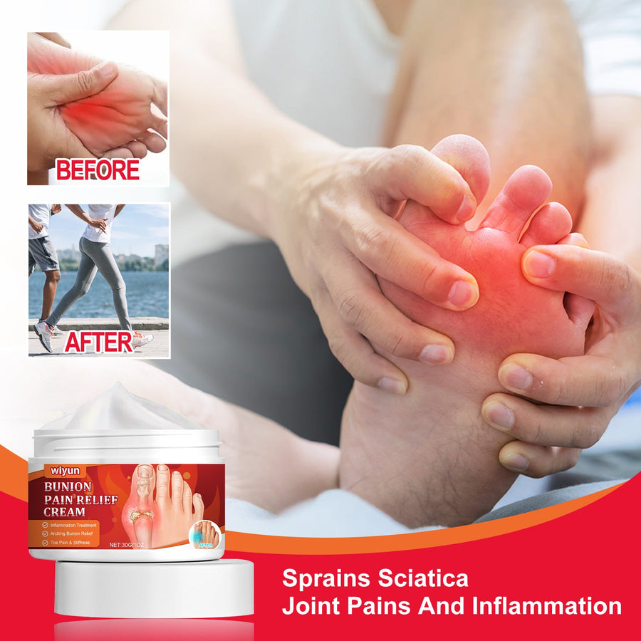 Bunion Pain Relief Cream – Herbal Formula for Foot Swelling
